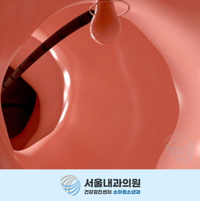 용인내시경