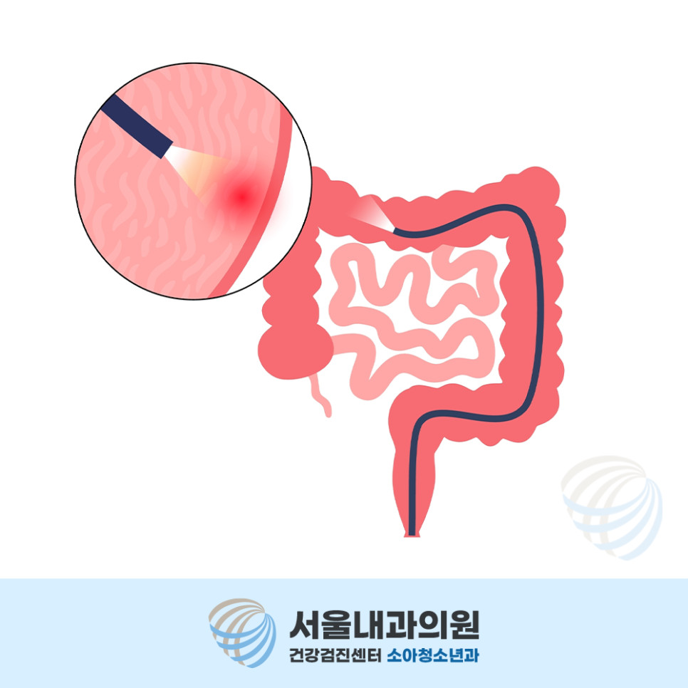 용인내시경
