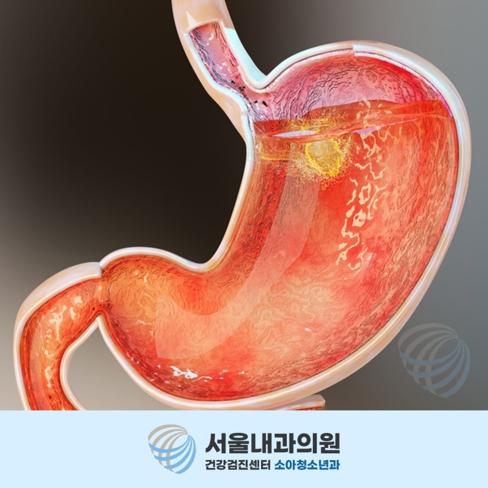용인내시경
