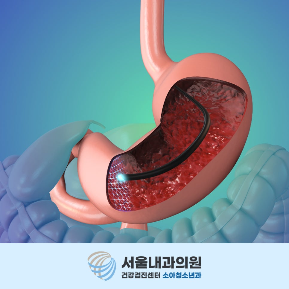 처인구내시경