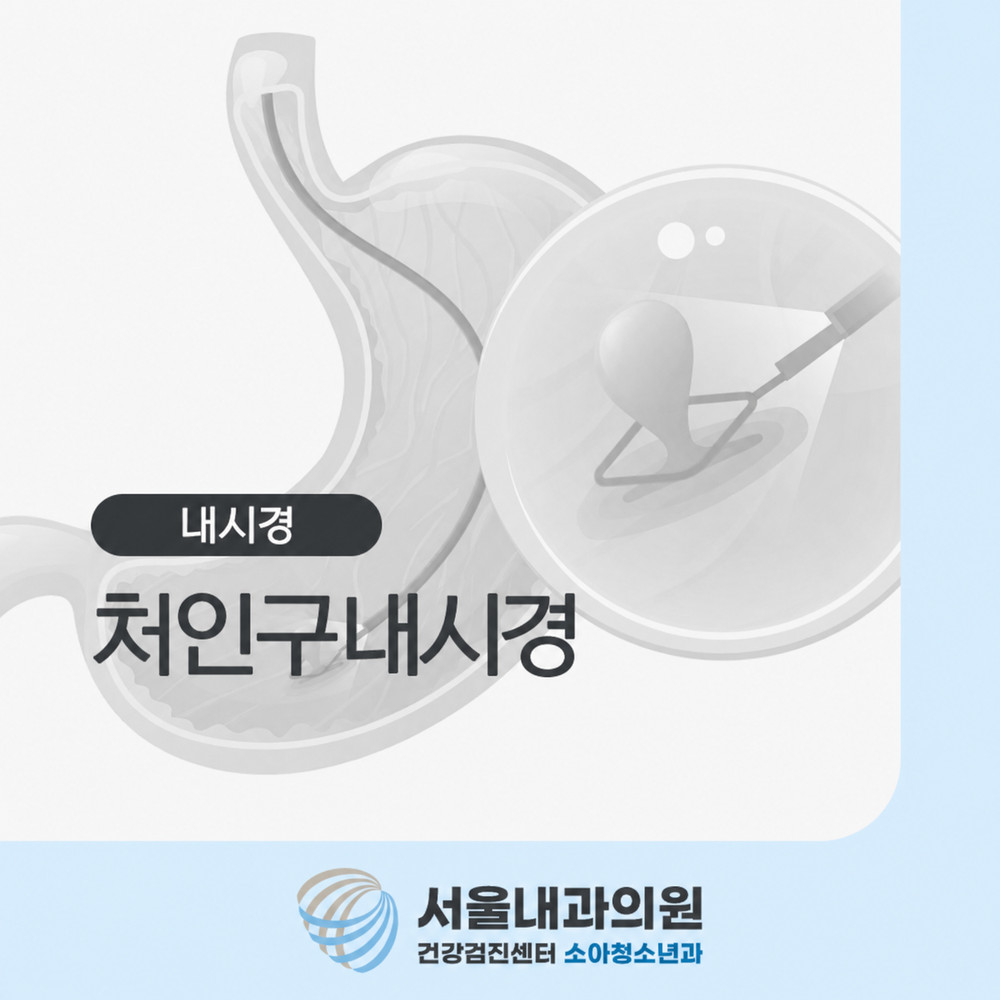 처인구내시경 식후 속쓰림과 명치 답답함 반복 시 위장 질환 꼼꼼한 확인 방법