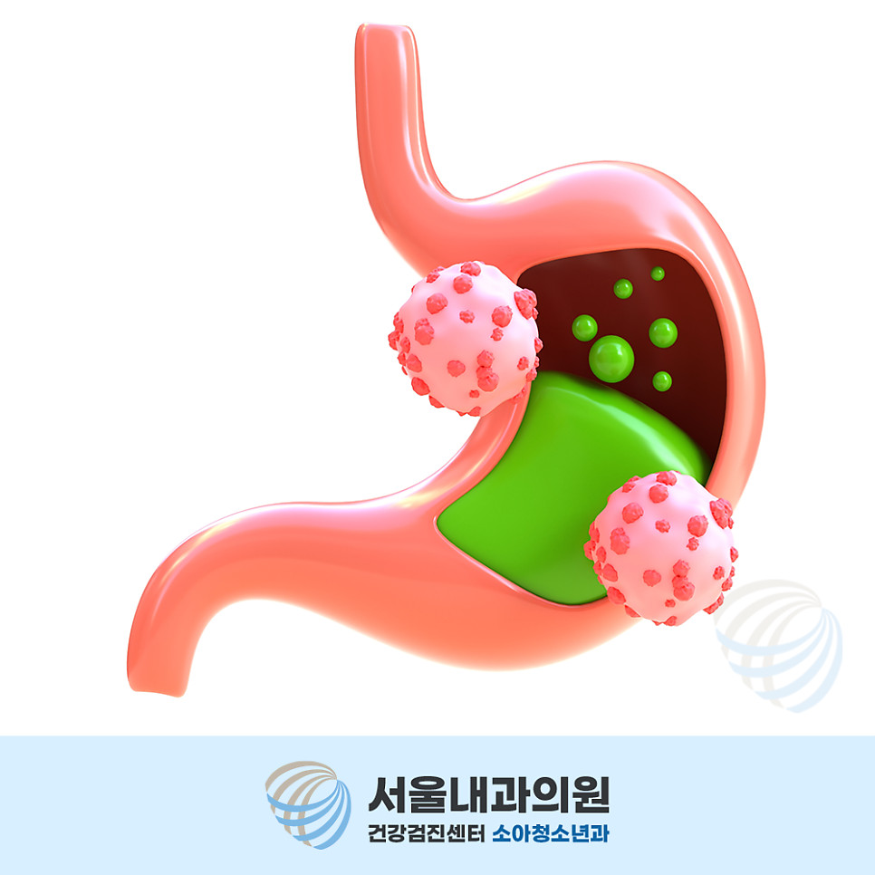 맵고 짠 음식과 헬리코박터균을 함께 살피는 과정